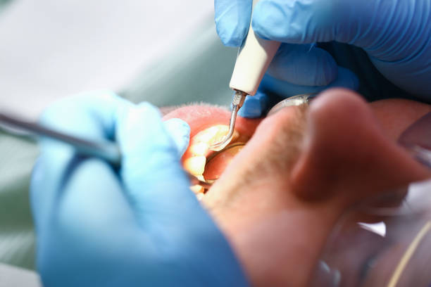 Best Urgent Dental Care for Toothache in Franklin Center, NJ
