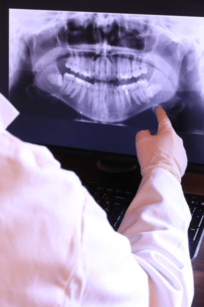 Best Emergency Dentist for Lost Fillings or Crowns in Franklin Center, NJ