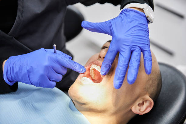 Best Emergency Dental Care for Abscessed Tooth in Franklin Center, NJ